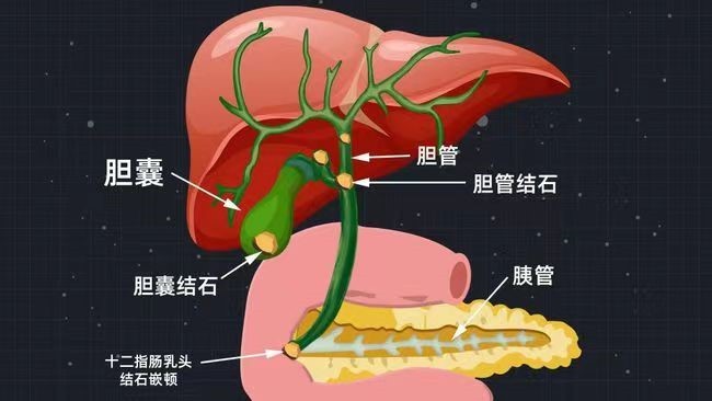 胆总管的位置图片图片