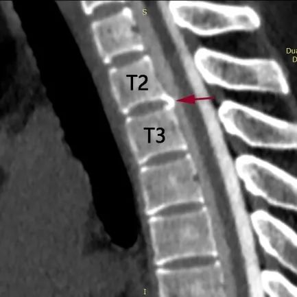 长时间玩手机或致"脑子漏水",这些征兆一定要留意!